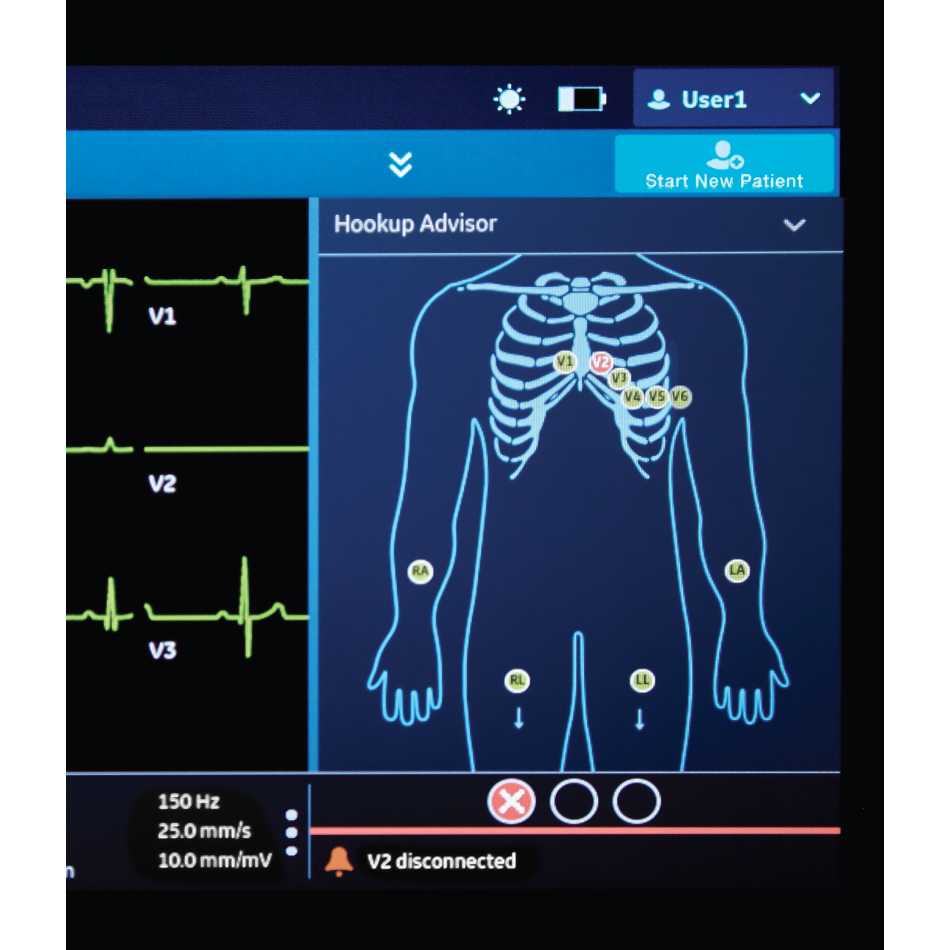 Aparat EKG MAC 5 A4 i A5 firmy GE HealthCare – wynajem – wynajem FizjoNaWynos.pl