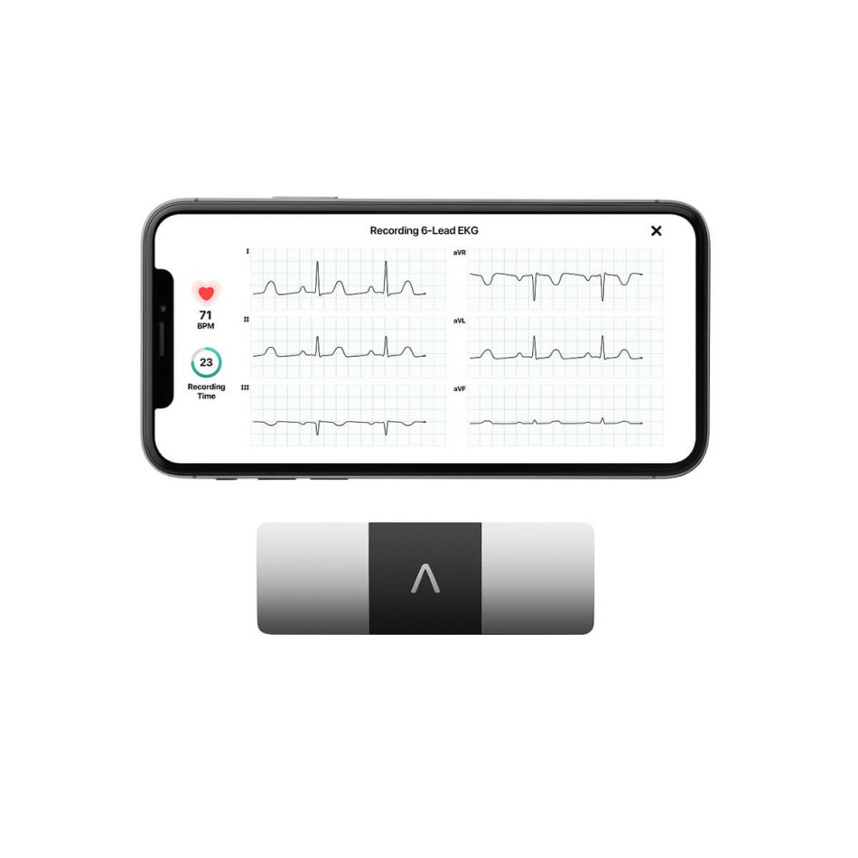 KardiaMobile 6L – przenośny monitor EKG – wynajem – wynajem FizjoNaWynos.pl