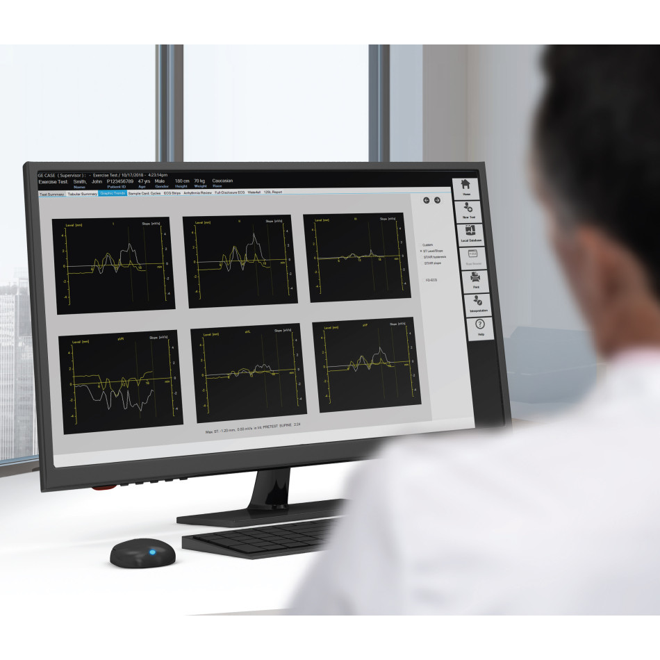 System badań kardiologicznych CardioSoft™ na wynajem – zdjęcie 4